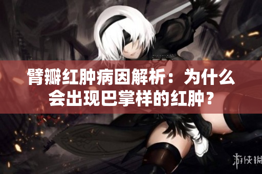 臂瓣紅腫病因解析：為什么會出現(xiàn)巴掌樣的紅腫？